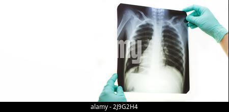 Mann Hand hält eine Lunge Radiographie isoliert auf einem weißen Hintergrund. Arzt mit Maske und Handschuhen, die auf die Röntgenaufnahme des Brustkorbs schauen Stockfoto