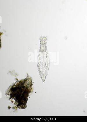 Bdelloid rotifer under the microscope Stock Photo