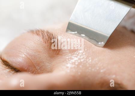 Hautpflege. Gesichtspeeling Mit Ultraschall-Kavitation. Hautreinigung. Nahaufnahme. Stockfoto