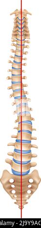 Anatomie der menschlichen Wirbelsäule – Skoliose-Komposition mit isoliertem Bild der gekrümmten Wirbelsäule mit Knochen und gerader Vektordarstellung Stock Vektor