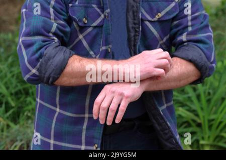 Mann kratzt an einem Juckreiz auf seinem Arm Stockfoto