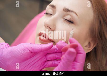 Das Weibchen erhält Injektionen mit Hyaluronsäure zur Glättung von Gesichtsfalten Stockfoto