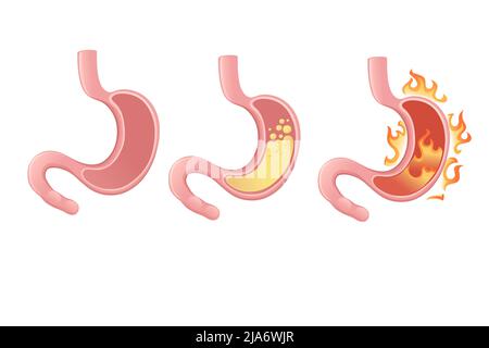 Menschlicher Magen Cartoon Design menschliche Anatomie Organ Vektor Illustration auf weißem Hintergrund Stock Vektor