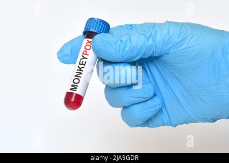 Arzt, der mit dem Monkeypox-Virus infiziertes Blut in einem Reagenzglas hält. Monkeypox-Virus (MPXV)-Konzept. Stockfoto