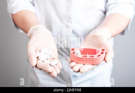 Zahnarzt zeigt Kiefermodell mit Einzelzahn und abgefallenen Zähnen in der Hand zum Patienten. Auswirkungen von schlechter Mundpflege, Zahnerkrankungen. Stomatologie-Konzept. Hochwertige Fotos Stockfoto