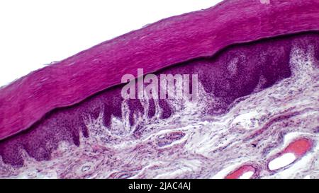 Leichte Mikrographie des epithelialen Gewebes aus der Haut. Menschlicher Fingerschnitt mit Epidermis, Dermis und Bindegewebe. Stockfoto