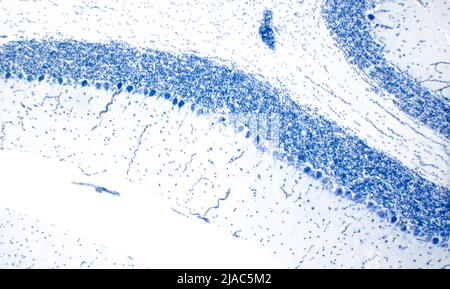 Zerebellum. Purkinje-Zellen. Cresyl-Violette Färbung (Nissl-Färbung). Stockfoto