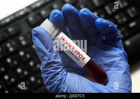 Monkeypox-Reagenzglas in der Hand der Ärzte im Labor, medizinisches Personal hält Blutprobe für Pockenvirus-Diagnose und Affenpocken-Forschung. Konzept von Monke Stockfoto
