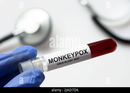 Monkeypox-Teströhrchen in der Hand des Arztes, medizinisches Personal hält Blutprobe für die Pockenvirus-Diagnose und Affenpocken-Forschung. Konzept von monkeypox ou Stockfoto