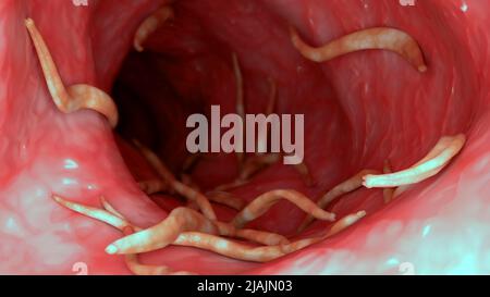 Konzeptionelle biomedizinische Illustration von Ascaris lumbricoides im menschlichen Darm. Stockfoto