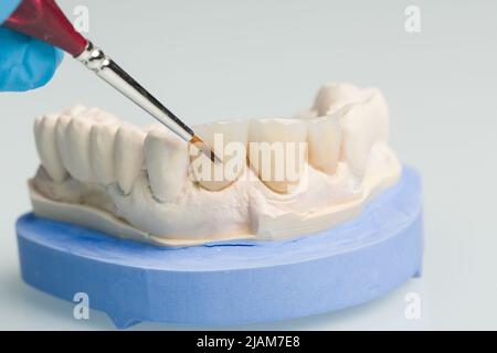 Nahaufnahme der Lackarbeiten an Prothesenteilen im Dentallabor Stockfoto