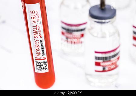 Durch Affenpocken kontaminiertes Blut, das im Labor, in Nahaufnahme und bei der Bekämpfung von Epidemien analysiert wird Stockfoto