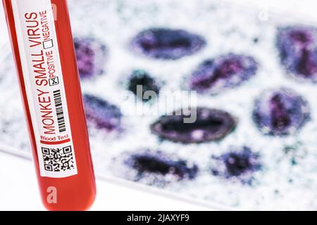 Röhrchen zur Blutentnahme mit Monkeypox-kontaminiertem Blut, Foto des Variola-Virus im Hintergrund, Epidemien-Kontrolle Stockfoto