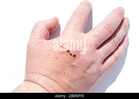 Eine Wunde an der Hand eines Mannes mit roten Bluttropfen. Die Katze kratzte sich an der Hand des Besitzers. Stockfoto