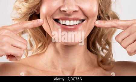 Mundpflege. Schöne Frau Mittleren Alters, Die Mit Den Fingern Auf Ihr Lächeln Zeigt Stockfoto
