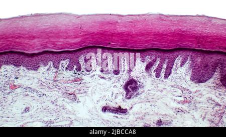 Haut. Lichtmikroskop des Epithelgewebes aus der Haut. Menschlicher Fingerschnitt mit Epidermis, Dermis und Bindegewebe. Hämatoxylin und Eosin Stockfoto