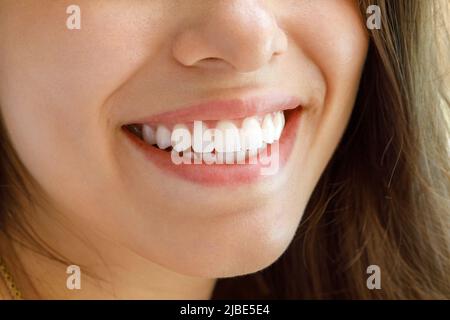 Schönes weibliches Lächeln. Gesunde weiße Zähne einer jungen Frau. Stockfoto