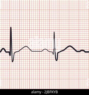 Nahtloser Elektrokardiogramm-Hintergrund. Aufzeichnung der Herzfrequenz auf pinkem ekg-Papier. Millimeterdiagramm und Kurve des kardiologischen Rhythmus. Medizinischer Vektor de Stock Vektor