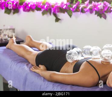 Der Masseur macht eine Massage mit Vakuumgläsern mit weiblicher Rückeninnsel. Stockfoto