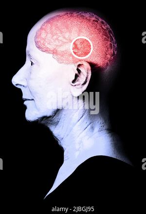 Wie das Gehirn funktioniert. Synapsen und Neuronen. Verbindungen. Kümmern Sie sich um Ihr Gehirn. Degenerative Erkrankungen, Parkinson und Alzheimer, ältere Frau Stockfoto