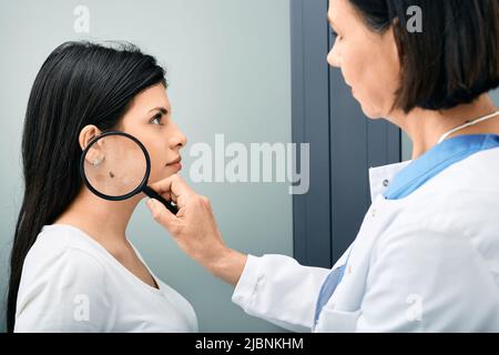 Mole-Dermoskopie, Melanom-Prophylaxe. Arzt untersucht den Hals der Frau mit Muttermal oder Muttermal mit Lupe Stockfoto