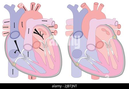 Anatomische Zeichnung des Herzens in einem Abschnitt. Hintergrund für medizinische Untersuchungen, Broschüren, Broschüren, Flyer. Visuelle Hilfe für die Untersuchung der menschlichen Anatomie. Stock Vektor