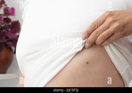 Eine Frau mit einem Muttermal auf einem hochgezogene Körpertuch Stockfoto