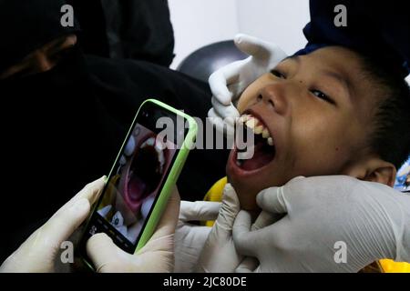 Zahnärztliche und orale Gesundheitschecks für zerebratische Kinder in Bogor City, West Java, Indonesien, am 5. Juni 2022. Stockfoto