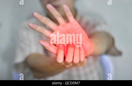 Schmerzhafter Palmar-Aspekt des asiatischen jungen Mannes. Konzept des Kompartiment-Syndroms, Zellulitis und Schmerzen der Handmuskulatur. Stockfoto