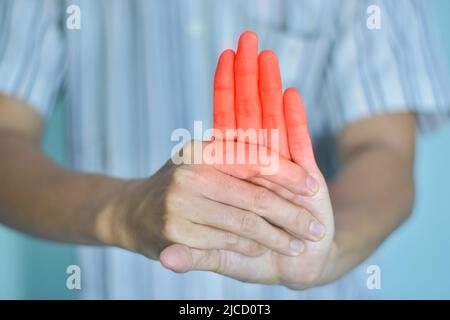 Entzündung in den Fingern des jungen südostasiatischen Mannes. Konzept von rheumatoider Arthritis, Arthrose oder Gelenkschmerzen. Stockfoto