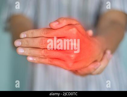 Metacarpophalangealgelenke Entzündung. Konzept und Idee von rheumatischer Arthritis, Gicht, Schwellung der Handgelenke oder Arthralgie. Stockfoto