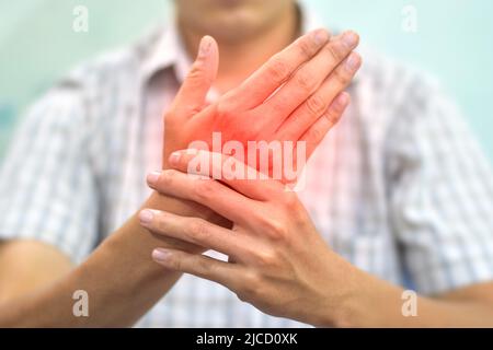 Entzündung der Handgelenke. Konzept und Idee von rheumatischer Arthritis, Gicht, Gelenkschwellung oder Arthralgie. Stockfoto