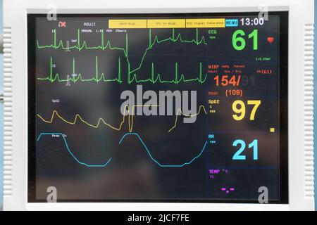 EKG-Maschine in der Notaufnahme des Krankenhauses zur Diagnose eines Herzinfarkts Stockfoto