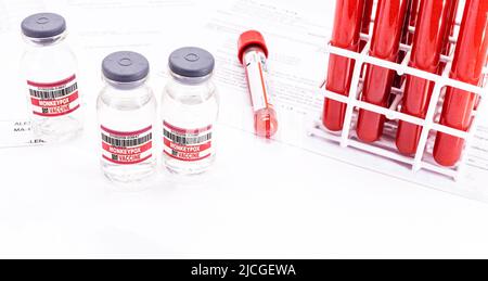 Ampullen oder Fläschchen mit Impfstoff gegen Monkeypox, seltene Krankheiten, Pharmaindustrie, Forschung zur epidemischen Impfung, Kopierraum Stockfoto