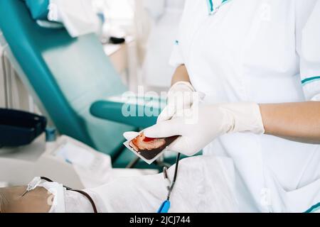 Die Krankenschwester hält einen Blutbeutel in ihren Händen. Internationaler Tag Der Blutspende. Prozess der Bluttransfusion im medizinischen Krankenhaus. Stockfoto