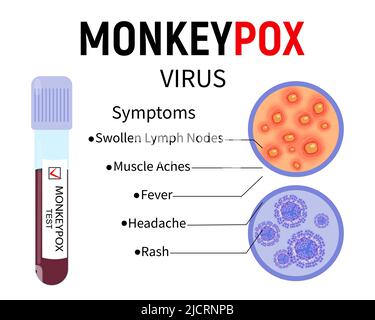 Reagenzglas mit Blut für Monkeypox-Virus-Test, menschliche Hautprobe mit Hautausschlag und Viruszellen auf weißem Hintergrund. Symptome von Monkeypox. Vektor Stock Vektor