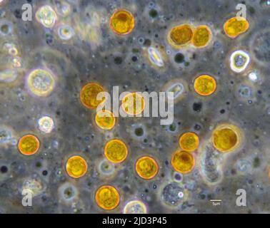 Mikroskopische Aufnahme von symbiotischen Algen (Zooxanthellae) der Dinoflagellat-Gattung Cladocopium. Probe aus einer weichen Koralle (Sinularia sp.). Stockfoto