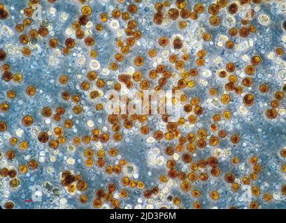Zooxanthellae aus einer weichen Koralle (wahrscheinlich Sinularia sp.). Die einzelnen Zellen haben einen Durchmesser von 10-12 µm. Stockfoto