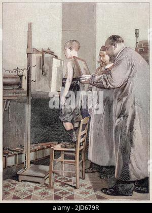 William Konrad Roentgen untersucht einen Patienten. Er erhielt den Nobelpreis für Physik 1901 für seine Entdeckung im Jahr 1895 von dem, was bekannt werden sollte, als das Röntgen. Kolorierte Version von : 10015067 Datum: 1896 Stockfoto