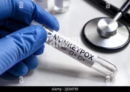 Monkeypox PCR-Teströhrchen in der Hand von Ärzten, medizinisches Kit für die Diagnose von Affenpocken-Viren und Pockenforschung im Labor. Konzept der Affenpocken, Tests, re Stockfoto