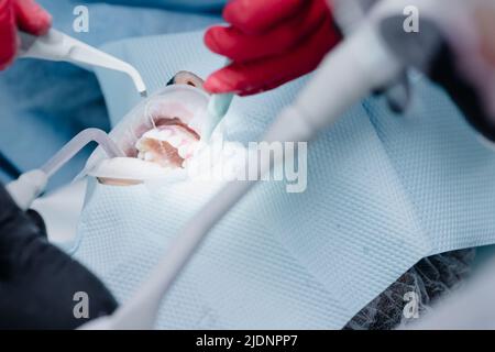 Zahnärztinnen behandeln die Zähne des Patienten. Den Mund mit Wasser reinigen. Schließen. Hochwertige Fotos Stockfoto