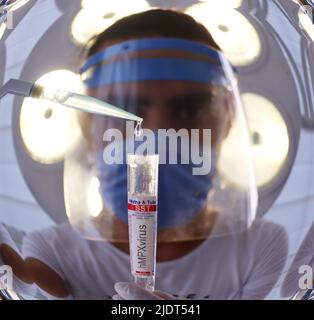 Monkeypox-Virus, hMPXV-Probenverarbeitung durch Laborant (Fischaugenlinse) Stockfoto