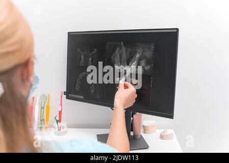 Die Zahnärztin zeigt mit einem Werkzeug auf den Bildschirm mit einem Röntgenfilm einiger Zähne. Stockfoto