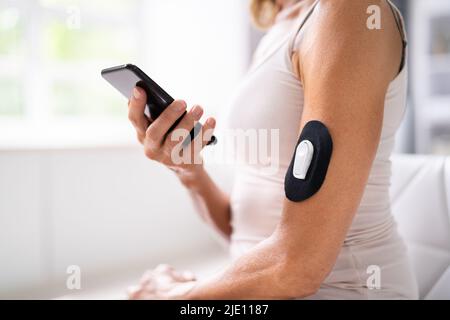 Frau, Die Einen Diabetes-Sensor Mit Kontinuierlichem Glukose-Fernmonitor Verwendet Stockfoto