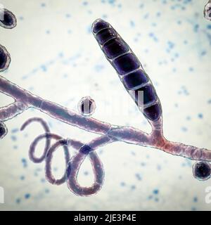 Pilze Trichophyton mentagrophytes, die Ursache des Fußes des Athleten (Tinea pedis), des Kopfhautringwurms (Tinea capitus) und der Nagelinfektion (Onychomykose), Illustration. T. mentagrophytes ist eine von vielen Pilzarten, die in der menschlichen Haut wachsen und Entzündungen und Juckreiz verursachen können. Fußpilz, Ringwurm und Onychomykose werden mit Antimykotika behandelt. Die Abbildung zeigt Septahyphen, Spiralhyphen, zwei Arten von Konidien (Strukturen, die Pilzsporen enthalten, die Infektionen übertragen): Makrokonidium (mehrzellige Körper) und sphärische Mikrokonidien (einzellige Körper). Stockfoto