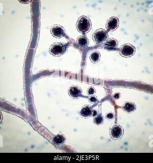 Pilze Trichophyton mentagrophytes, die Ursache des Fußes des Athleten (Tinea pedis), des Kopfhautringwurms (Tinea capitus) und der Nagelinfektion (Onychomykose), Illustration. T. mentagrophytes ist eine von vielen Pilzarten, die in der menschlichen Haut wachsen und Entzündungen und Juckreiz verursachen können. Fußpilz, Ringwurm und Onychomykose werden mit Antimykotika behandelt. Die Abbildung zeigt septate Hyphen und verzweigte Konidiophore mit sphärischen Mikrokonidien (einzellige Körper). Stockfoto