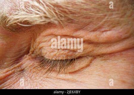 Nahaufnahme mit geschlossenen Augen. Geschlossenes Auge mit schwerem Ermüdungskonzept Stockfoto