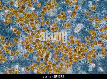 Mikroskopische Aufnahme von symbiotischen Algen (Zooxanthellae) der Dinoflagellat-Gattung Cladocopium. Probe aus Sinularia sp. Stockfoto