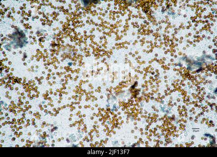 Mikroskopische Aufnahme von symbiotischen Algen (Zooxanthellae) der Dinoflagellat-Gattung Cladocopium. Probe aus Sinularia sp. Stockfoto