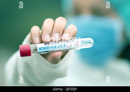 Krankenschwester mit einem Reagenzglas mit Monkeypox-Virus-Etikett Stockfoto